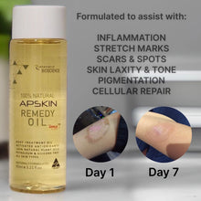 Load image into Gallery viewer, Renovatio APSKIN Remedy Oil